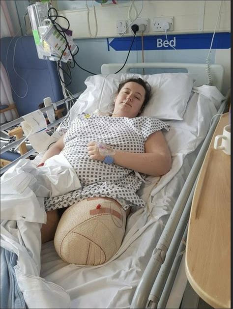 Strangers Paid For My Amputation Chronic Pain Meant Losing A Leg Uk