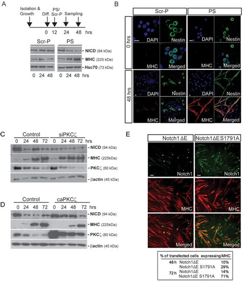 Regulation of Notch1 by PKCζ affects myoblast differentiation A