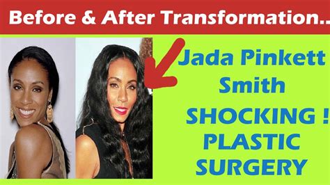 Jada Pinkett Smith Plastic Surgery Before And After Full