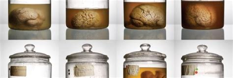 Texas Labs Solve 20 Year Old Case Of Missing Brains Ars Technica