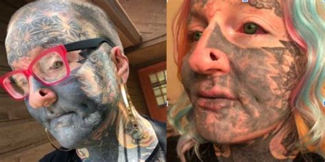 Flawless Before And After Facial Tattoo Removal Removery