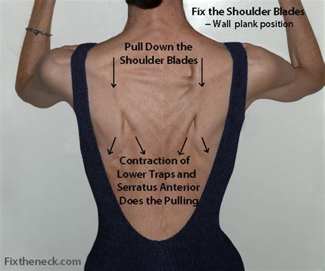 Overcoming Chronic Neck Pain Postural Causes And A Unique Exercise Fix