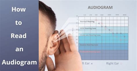 How To Read An Audiogram Absolute Audio