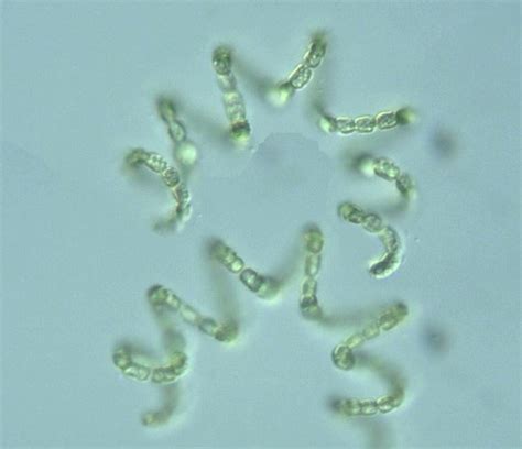 Cyanobacteria Anabaena