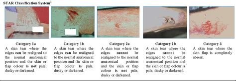 Classification Of Skin Tears