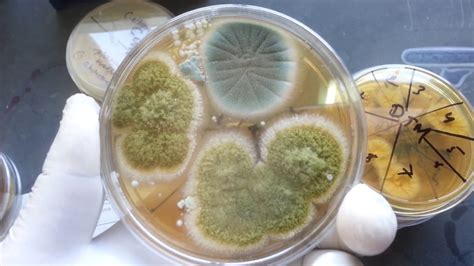 Various Fungal Media And Its Usage Fungal Growth Macroscopic