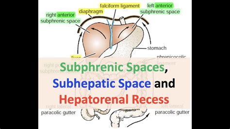 Subphrenic And Subhepatic Spaces And Hepatorenal Recess Youtube