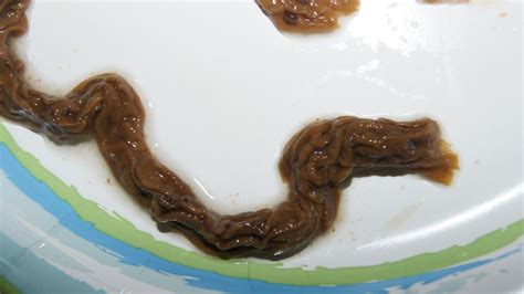 graphic are these rope worms mucus lymph tissue or something else help needed at parasites