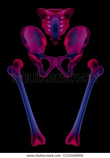 Xray Separate Human Hip Femur Bone Stock Illustration 1122668006
