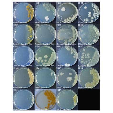 Representative Bacterial Colonies With Different Morphologies Growing