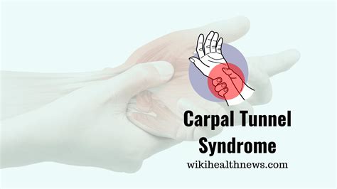 Carpal Tunnel Syndrome Causes Pain In Hand Wiki Health News