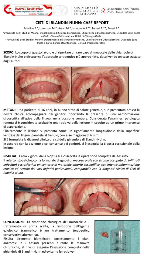 Pdf Enucleation Of A Neoformation In The Ventral Part Of The Tongue