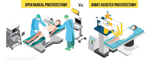 Success Of Radical Prostatectomy Be It Open Or Robotic Depends On Experience Of Surgeon