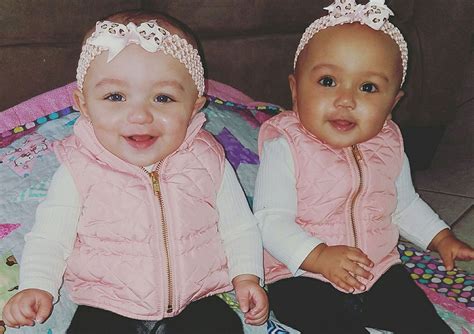 Biracial Twins Born In Illinois ‘its So Rare Biracial Twins Twin
