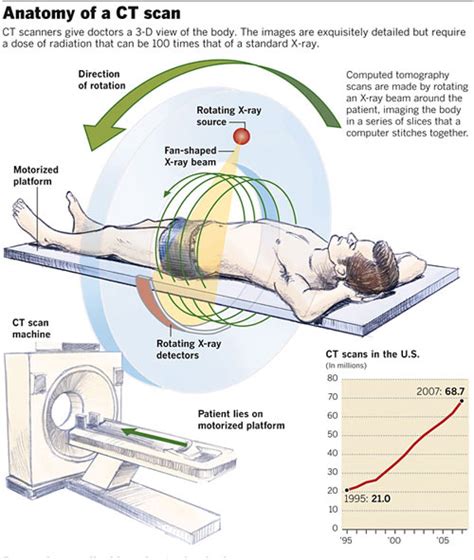 Qa Computed Tomography On Emaze