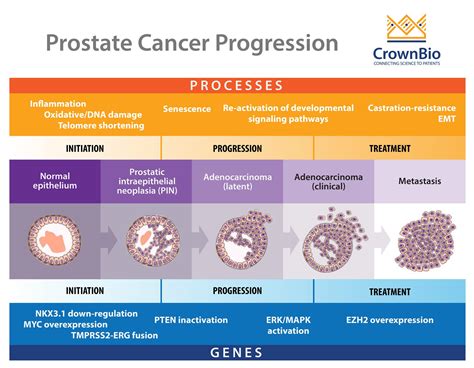 Why Are Prostate Cancer Preclinical Models Hard To Develop