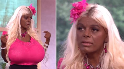 Woman Obsessed With Tanning Injections Wants More Surgery Toktok9ja Media