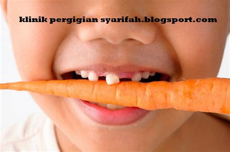 Cari klinik gigi terdekat, daftar online dokter, alamat, dokter yang berpraktik, fasilitas dan tarif kamar rawat inap, serta informasi layanan kesehatan lain hanya di sehatq. KLINIK PERGIGIAN SYARIFAH: MASAALAH GIGI SUSU (GIGI KANAK ...