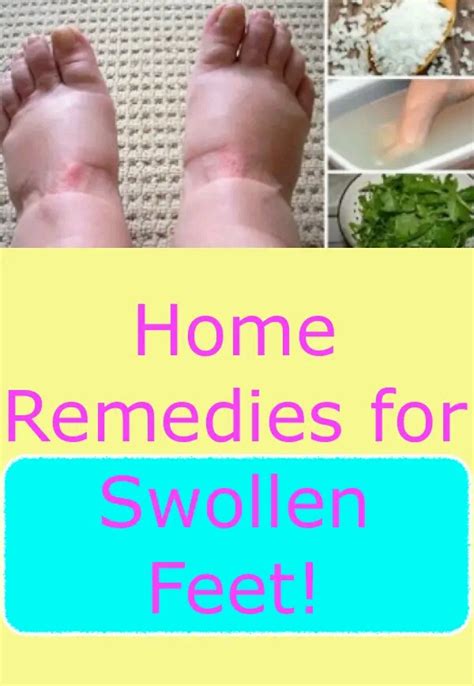 Home Remedies For Swollen Feet Thingscouplesdo
