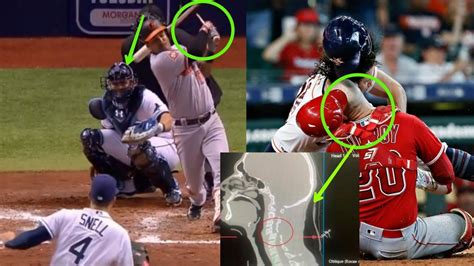 MLB Catchers Injuries And Hit By The Ball YouTube