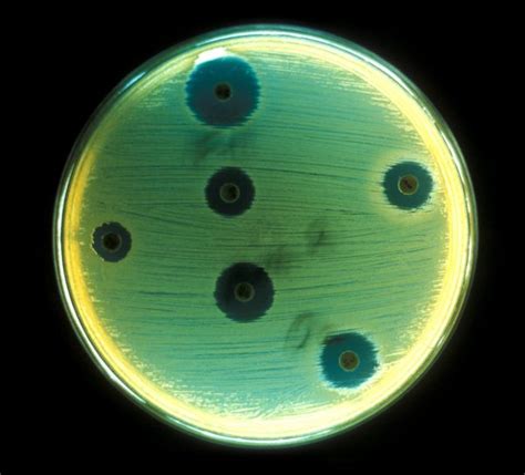 Free Picture Aerobic Bacteria Staphylococcus Aureus Cultured Agar