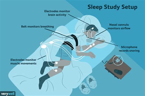 Sleep Study Polysomnogram What To Expect