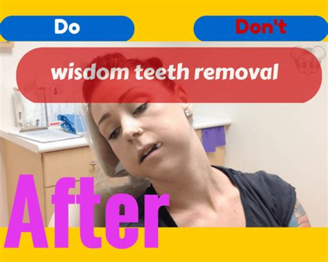 There are several alternative methods to tooth. After Wisdom Teeth Removal Recovery Tips, Foods, Pain ...