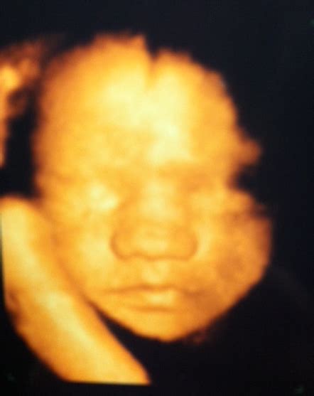 Baby Finley 4d Ultrasound 29 Weeks 3 Days