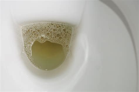 Bubbles Vs Foam In Urine Urine The Wrong Color Ask Dr Weil