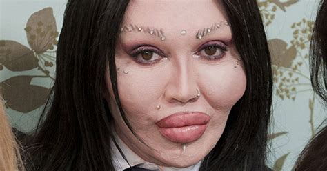 Pete Burns Before Surgeries What The Dead Or Alive Star Looked Like