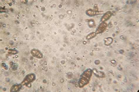 Microscopy Of The Alternaria Fungus Macroconidia Stock Photo Image Of