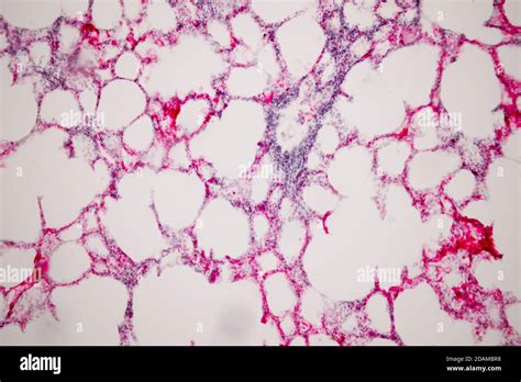Human Lung Normal Tissue Hi Res Stock Photography And Images Alamy