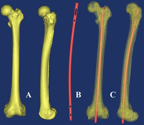 Trochanteric Fossa Of Femur