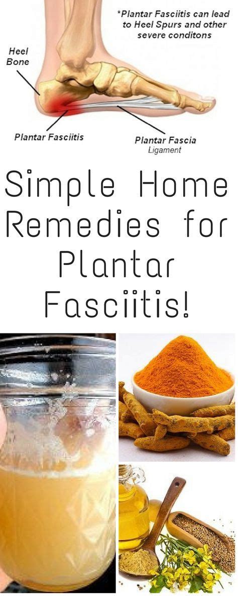 Simple Home Remedies For Plantar Fasciitis Remedies For Plantar