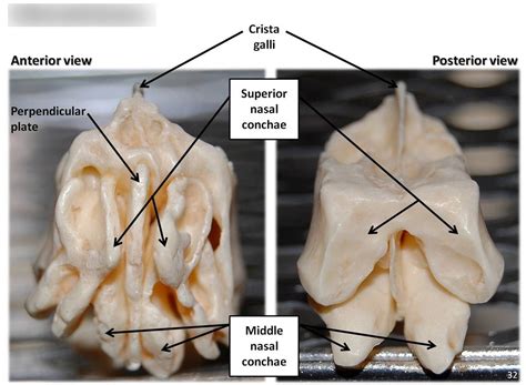 Ethmoid Bone And Inferior Nasal Conchae Diagram Quizlet