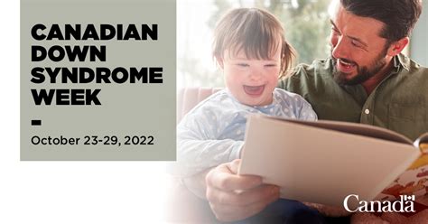 This Week Marks Canadian Down Syndrome Week The Ranch 1001 Fm