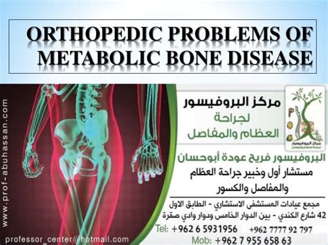 Orthopedic Disorders Of Metabolic Bone Disease البروفيسور فريح عوده
