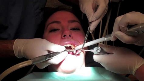 What Is It Like To Get A Filling In Your Tooth With Footage From The Dentists Office Youtube