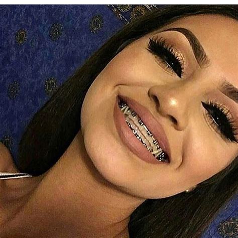 Girls With Braces Viral Explore Explorepage Braceface Braces Pretty Cute Sexy Get You