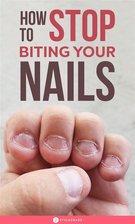 Sleeping well directly affects your mental and physical health. How To Stop Biting Your Nails in 2020 (With images) | Nail ...