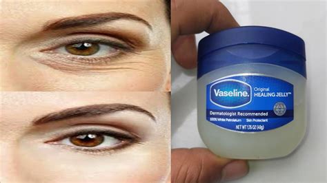 How To Remove Wrinkles Under Eyes Naturally With Vaseline Bags Under