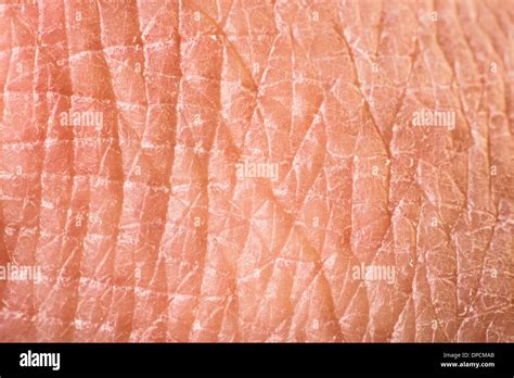 Human Skin Texture Closeup Detail Hi Res Stock Photography And Images