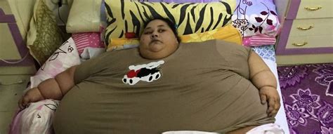 Dickste Frau Der Welt Operiert 500 Kilo Frau Speckt 250 Kilo Ab N Tvde