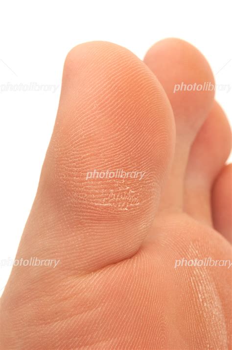 足の指の角質 写真素材 フォトライブラリー photolibrary