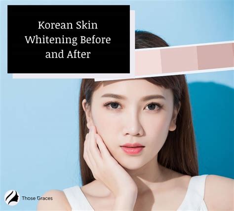 Korean Skin Whitening Before And After With Videos