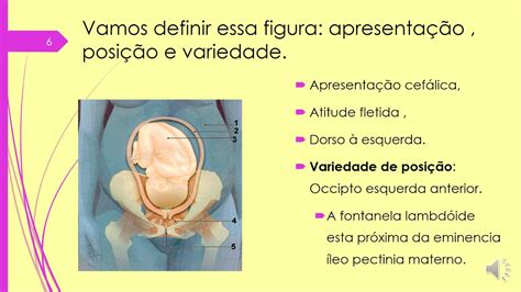 Variedade De Posição Fetal