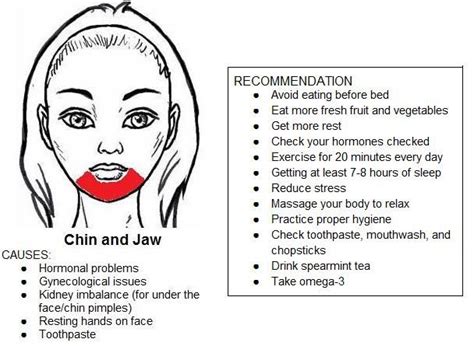 5 Tips To Get Rid Of Your Acne Chin Acne Treatment Acne Mapping