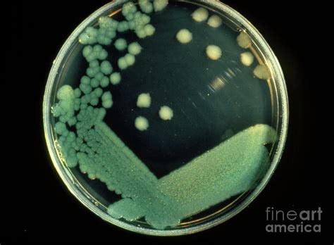 Pseudomonas Aeruginosa Bacteria Photograph By John Durhamscience Photo