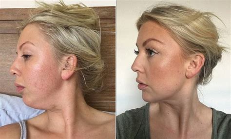 face yoga for double chin exercises before and after