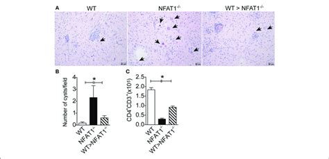 Nfat1 Expression On Ly6c Hi Monocytes Plays An Essential Role In The